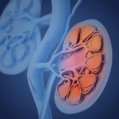 news240x240_cme-ckd.jpg