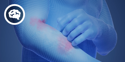 DocCheck eCME: atopische Dermatitis (2 CME-Punkte)